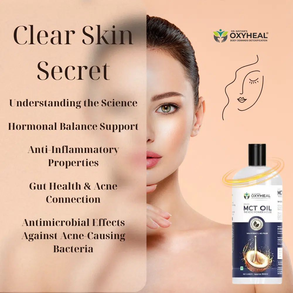 MCT Oil for Acne: A Clear Skin Secret? Benefits, Uses & Scientific Insights